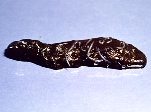 Nematodes
 Pinworm Eggs In Poop