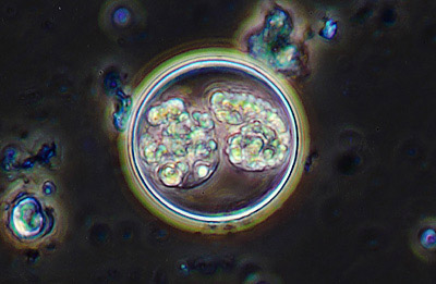 Latest Microscopic Images 最新顕微鏡画像:Coccidium(Phase contrast) コクシジウム(位相差) Photo:Akira Yamanouchi.