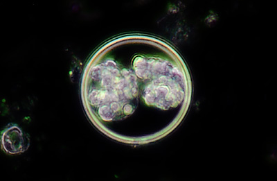 Latest Microscopic Images 最新顕微鏡画像:Coccidium(Dark field) コクシジウム(暗視野) Photo:Akira Yamanouchi.