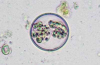 Latest Microscopic Images 最新顕微鏡画像:Coccidium(Bright field) コクシジウム(明視野) Photo:Akira Yamanouchi.