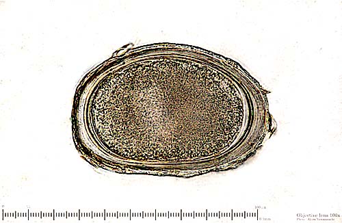 Latest Microscopic Images 最新顕微鏡画像:Oxyurid egg of cockatiel. オカメインコ蟯虫卵 Photo:Akira Yamanouchi.