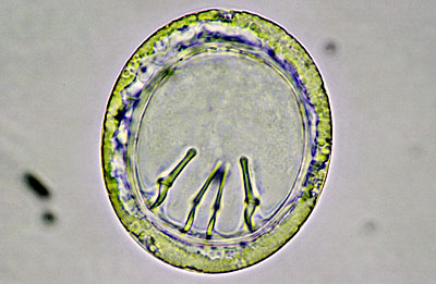 Latest Microscopic Images 最新顕微鏡画像:イグアナ：条虫卵 Photo:Akira Yamanouchi.