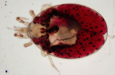 Latest Microscopic Images 最新顕微鏡画像:Mite from a hamster ハムスター：ダニ Photo:Akira Yamanouchi.