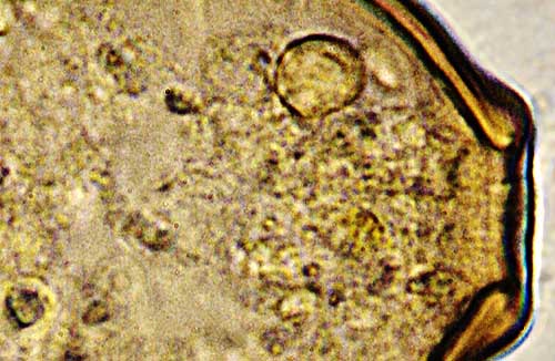 Latest Microscopic Images 最新顕微鏡画像:Limit of optical microscope ? 光学顕微鏡の限界？ Photo:Akira Yamanouchi.