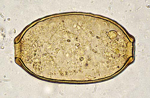 Latest Microscopic Images 最新顕微鏡画像:Hairworm egg detected from a hamster ハムスター毛細線虫虫卵 Photo:Akira Yamanouchi.
