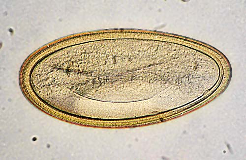 Latest Microscopic Images 最新顕微鏡画像:Oxyurid egg detected from a hamster ハムスター蟯虫卵 Photo:Akira Yamanouchi.