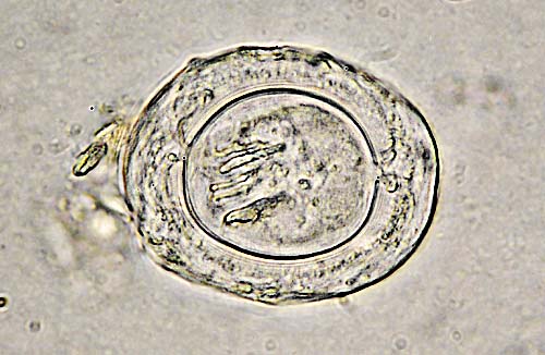 Latest Microscopic Images 最新顕微鏡画像:Egg of <i>Hymenolepis nana</i> detected from a hamster ハムスターの小型条虫卵 Photo:Akira Yamanouchi.