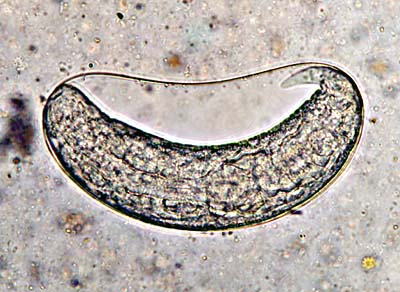 Latest Microscopic Images 最新顕微鏡画像:Iguana:Nematode egg イグアナ：線虫卵 Photo:Akira Yamanouchi.