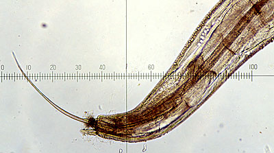 Latest Microscopic Images 最新顕微鏡画像:Tail part of male nematode detected from an iguana イグアナ：線虫オス尾部 Photo:Akira Yamanouchi.