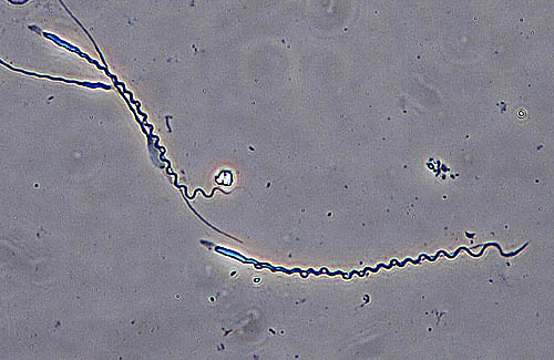 Latest Microscopic Images 最新顕微鏡画像:Spermatozoon of java sparrow ブンチョウの精子 Photo:Akira Yamanouchi.
