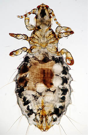 Latest Microscopic Images 最新顕微鏡画像:Lice from prairie dog 世界一美しいシラミの画像 Photo:Akira Yamanouchi.