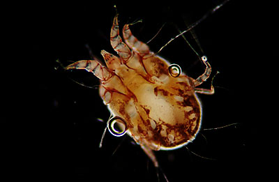 Latest Microscopic Images 最新顕微鏡画像:Rabbit:Ear mite ウサギ：ミミダニ Photo:Akira Yamanouchi.