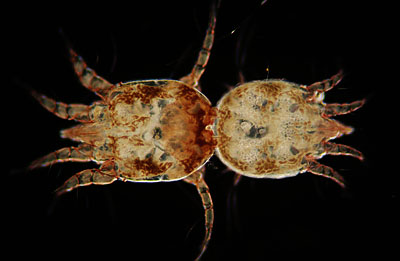 Latest Microscopic Images 最新顕微鏡画像:Rabbit:Ear mite ウサギ：ミミダニ(交尾中) Photo:Akira Yamanouchi.
