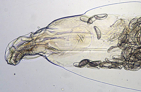 Latest Microscopic Images 最新顕微鏡画像:Detail of head part ウサギ蟯虫頭部詳細 Photo:Akira Yamanouchi.