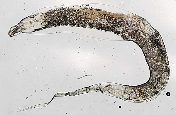 Latest Microscopic Images 最新顕微鏡画像:Full image of oxyurid body detected from a rabbit ウサギ蟯虫全体像 Photo:Akira Yamanouchi.