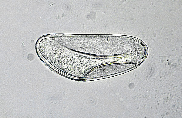 Latest Microscopic Images 最新顕微鏡画像:Egg of oxyurid from a rabbit ウサギ蟯虫卵 Photo:Akira Yamanouchi.