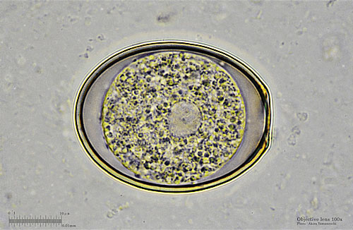 Latest Microscopic Images 最新顕微鏡画像:Coccidium(Bright field) コクシジウム(明視野) Photo:Akira Yamanouchi.
