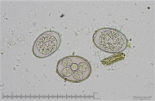 Latest Microscopic Images 最新顕微鏡画像:Coccidium(Bright field) コクシジウム(明視野) Photo:Akira Yamanouchi.