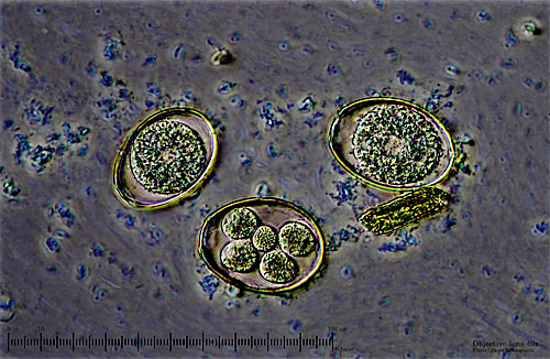Latest Microscopic Images 最新顕微鏡画像:Coccidium(Composition) コクシジウム(合成) Photo:Akira Yamanouchi.