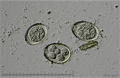Latest Microscopic Images 最新顕微鏡画像:Coccidium(Eccenteric illumination) コクシジウム(偏斜照明) Photo:Akira Yamanouchi.