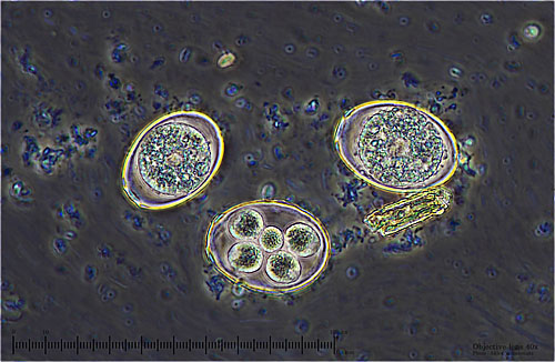 Latest Microscopic Images 最新顕微鏡画像:Coccidium(Phase contrast) コクシジウム(位相差) Photo:Akira Yamanouchi.