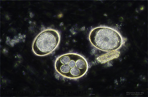 Latest Microscopic Images 最新顕微鏡画像:Coccidium(Dark field) コクシジウム(暗視野) Photo:Akira Yamanouchi.