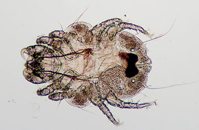 Latest Microscopic Images 最新顕微鏡画像:Rabbit:Cheyletidae ウサギ：ツメダニ Photo:Akira Yamanouchi.