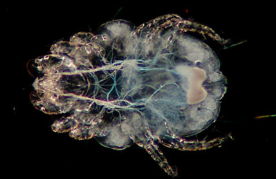 Latest Microscopic Images 最新顕微鏡画像:Rabbit:Cheyletidae ウサギ：ツメダニ Photo:Akira Yamanouchi.